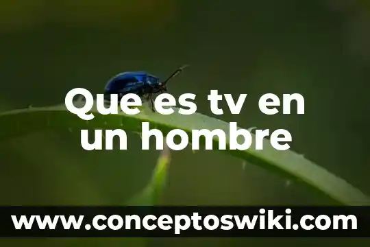 ¿Qué es rasiel hombre o mujer? 8 Que es tv en un hombre
