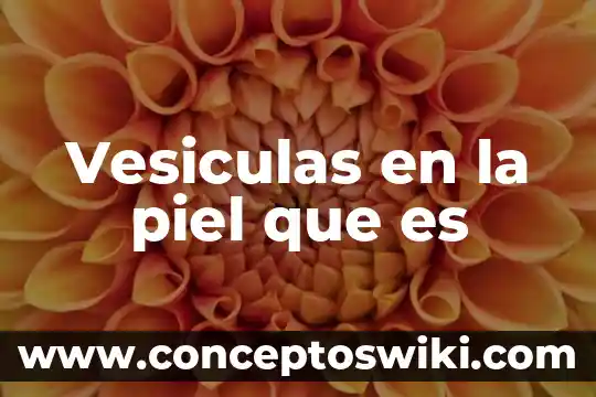 Que es bueno para el ardor de piel 8 Vesiculas en la piel que es